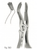 Extracting forceps for children fig. 563